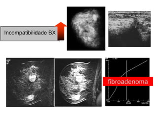 Incompatibilidade BX
 