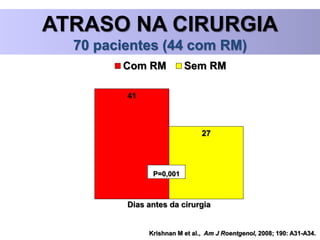 Krishnan M et al., Am J Roentgenol, 2008; 190: A31-A34.
ATRASO NA CIRURGIA
70 pacientes (44 com RM)
41
27
Dias antes da cirurgia
Com RM Sem RM
P=0,001
 