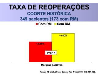 Pengel KE et al., Breast Cancer Res Treat, 2009; 116: 161-169.
TAXA DE REOPERAÇÕES
COORTE HISTÓRICA
349 pacientes (173 com RM)
13.80%
19.40%
Margens positivas
Com RM Sem RM
P=0,17
 