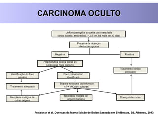 CARCINOMA OCULTO
Frasson A et al. Doenças da Mama Edição de Bolso Baseada em Evidências, Ed. Atheneu, 2013
 