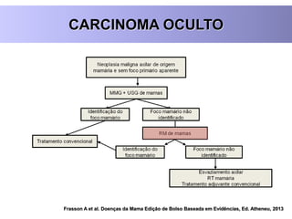 CARCINOMA OCULTO
Frasson A et al. Doenças da Mama Edição de Bolso Baseada em Evidências, Ed. Atheneu, 2013
 