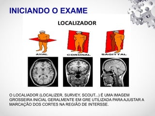 INICIANDO O EXAME
O LOCALIADOR (LOCALIZER, SURVEY, SCOUT...) É UMA IMAGEM
GROSSEIRA INICIAL GERALMENTE EM GRE UTILIZADA PARA AJUSTAR A
MARCAÇÃO DOS CORTES NA REGIÃO DE INTERSSE.
 
