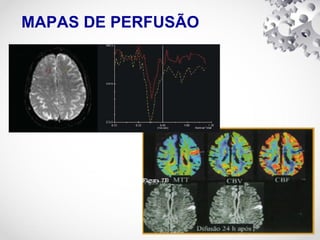 MAPAS DE PERFUSÃO
 