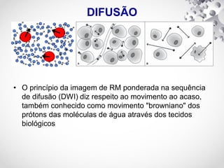 DIFUSÃO
• O princípio da imagem de RM ponderada na sequência
de difusão (DWI) diz respeito ao movimento ao acaso,
também conhecido como movimento "browniano" dos
prótons das moléculas de água através dos tecidos
biológicos
 