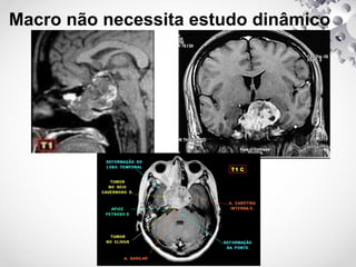 Macro não necessita estudo dinâmico
 