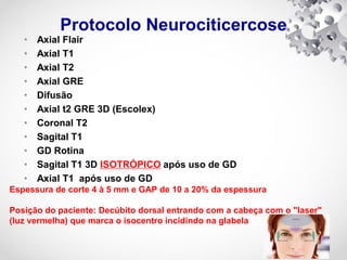 Protocolo Neurociticercose
• Axial Flair
• Axial T1
• Axial T2
• Axial GRE
• Difusão
• Axial t2 GRE 3D (Escolex)
• Coronal T2
• Sagital T1
• GD Rotina
• Sagital T1 3D ISOTRÓPICO após uso de GD
• Axial T1 após uso de GD
Espessura de corte 4 à 5 mm e GAP de 10 a 20% da espessura
Posição do paciente: Decúbito dorsal entrando com a cabeça com o "laser"
(luz vermelha) que marca o isocentro incidindo na glabela
 