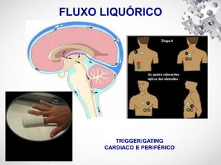 FLUXO LIQUÓRICO
TRIGGER/GATING
CARDIACO E PERIFÉRICO
 