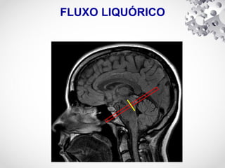FLUXO LIQUÓRICO
 