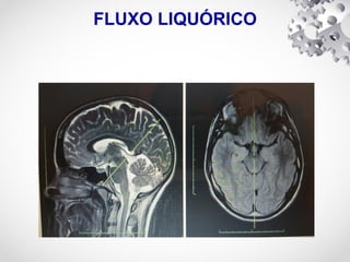 FLUXO LIQUÓRICO
 