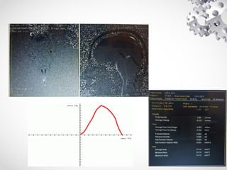 RM Protocolo Crânio.pdfi muito bom esse material estudem