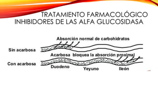 TRATAMIENTO FARMACOLÓGICO
INHIBIDORES DE LAS ALFA GLUCOSIDASA
 