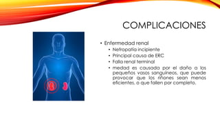 COMPLICACIONES
• Enfermedad renal
• Nefropatía incipiente
• Principal causa de ERC
• Falla renal terminal
• medad es causada por el daño a los
pequeños vasos sanguíneos, que puede
provocar que los riñones sean menos
eﬁcientes, o que fallen por completo.
 