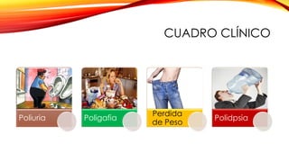 CUADRO CLÍNICO
Poliuria Poligafia
Perdida
de Peso
Polidpsia
 