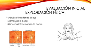 EVALUACIÓN INICIAL
EXPLORACIÓN FÍSICA
• Evaluación del fondo de ojo
• Examen de la boca
• Búsqueda intencionada de bocio
 
