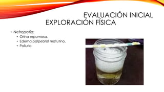 EVALUACIÓN INICIAL
EXPLORACIÓN FÍSICA
• Nefropatía:
• Orina espumosa.
• Edema palpebral matutino.
• Poliuria
 