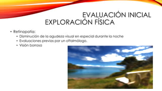 EVALUACIÓN INICIAL
EXPLORACIÓN FÍSICA
• Retinopatía:
• Disminución de la agudeza visual en especial durante la noche
• Evaluaciones previas por un oftalmólogo.
• Visión borrosa
 