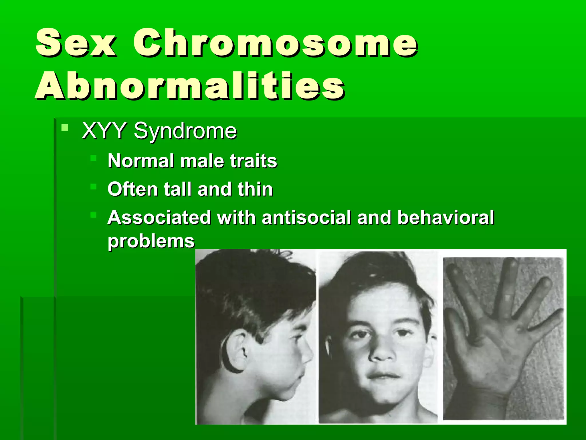 Sex Chromosome
Abnormalities
 XYY Syndrome
   Normal male traits
   Often tall and thin
   Associated with antisocial and behavioral
    problems
 