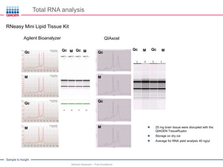 Sample to Insight
Total RNA analysis
QIAxcel Advanced – Pure Excellence
RNeasy Mini Lipid Tissue Kit
QIAxcelAgilent Bioanalyzer
Qc M Qc MQc M Qc MQc
M
Qc
M
Hirn
Qc
M
Qc
M  25 mg brain tissue were disrupted with the
QIAGEN TissueRuptor
 Storage on dry ice
 Average for RNA yield analysis 40 ng/µl
 
