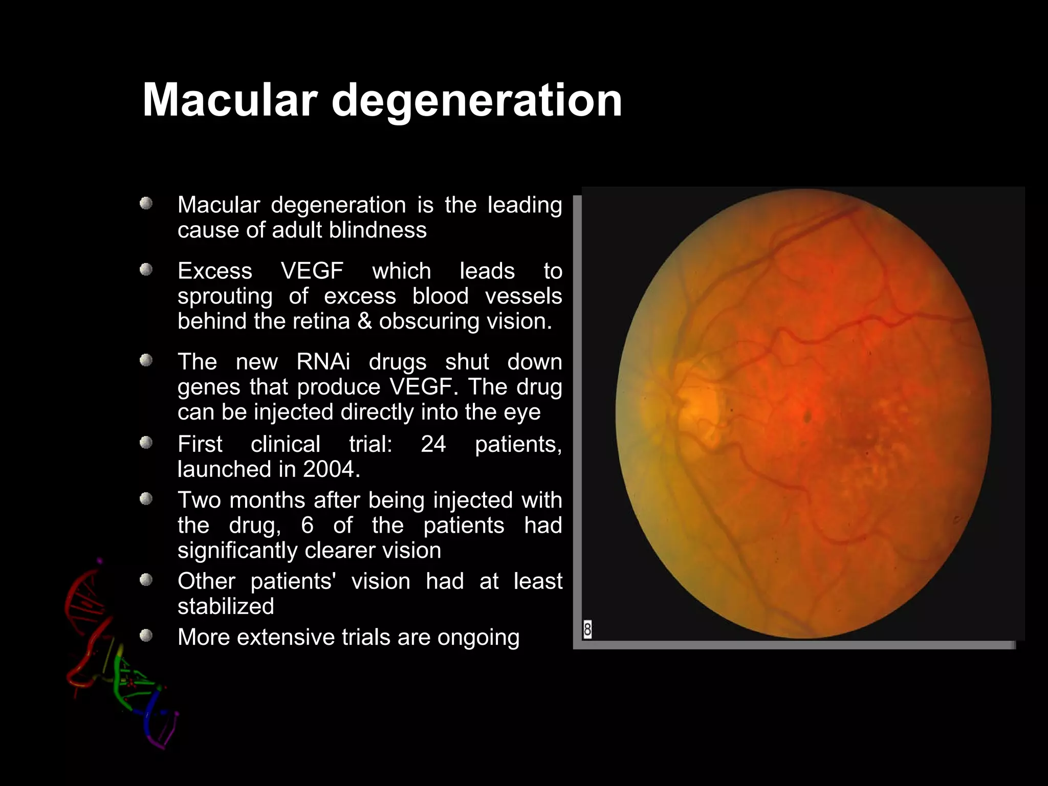 Macular degeneration

 Macular degeneration is the leading
 cause of adult blindness
 Excess VEGF which leads to
 sprouting of excess blood vessels
 behind the retina & obscuring vision.
 The new RNAi drugs shut down
 genes that produce VEGF. The drug
 can be injected directly into the eye
 First clinical trial: 24 patients,
 launched in 2004.
 Two months after being injected with
 the drug, 6 of the patients had
 significantly clearer vision
 Other patients' vision had at least
 stabilized
 More extensive trials are ongoing
 