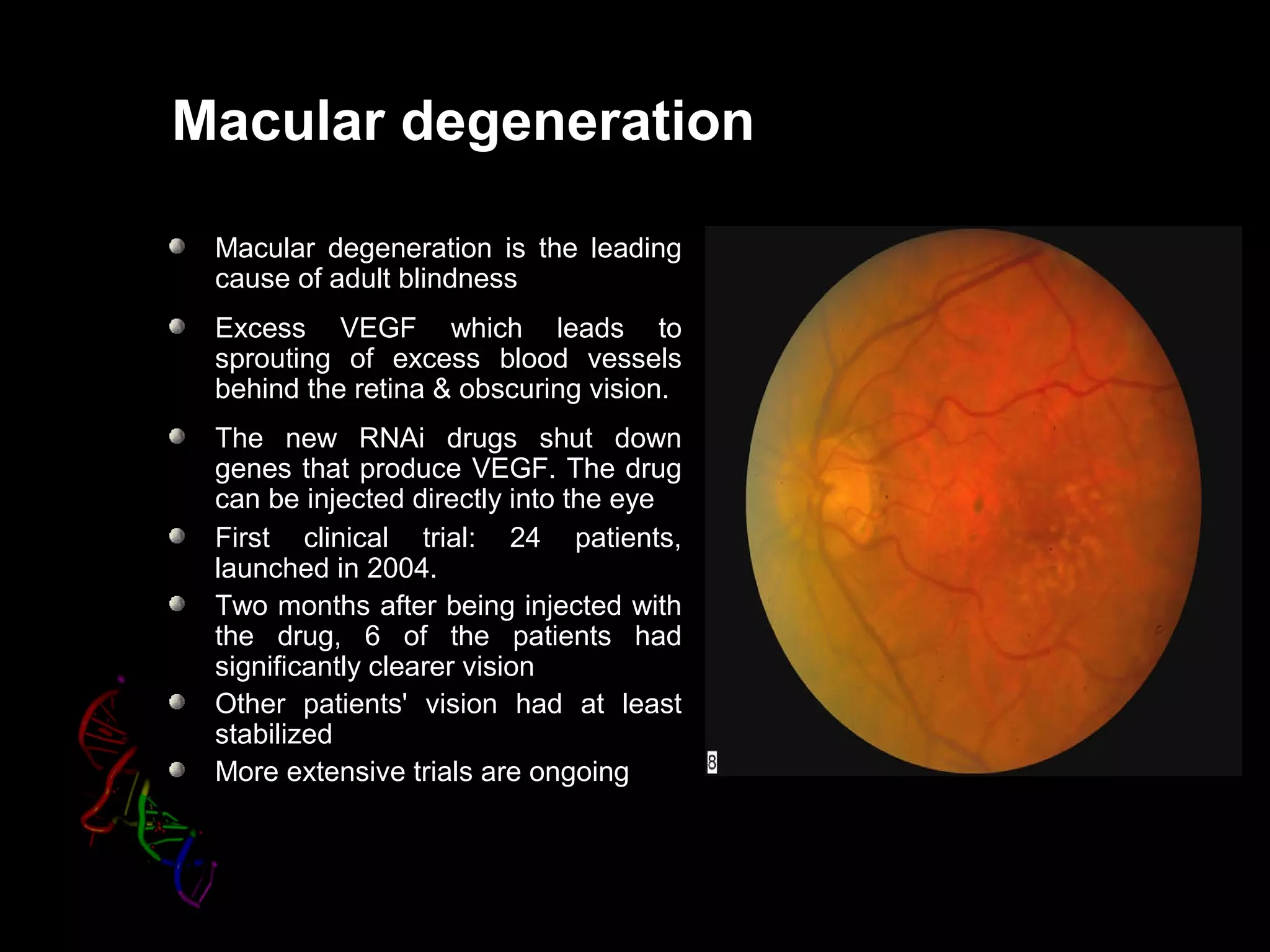 Macular degeneration
Macular degeneration is the leading
cause of adult blindness
Excess VEGF which leads to
sprouting of excess blood vessels
behind the retina & obscuring vision.
The new RNAi drugs shut down
genes that produce VEGF. The drug
can be injected directly into the eye
First clinical trial: 24 patients,
launched in 2004.
Two months after being injected with
the drug, 6 of the patients had
significantly clearer vision
Other patients' vision had at least
stabilized
More extensive trials are ongoing
 