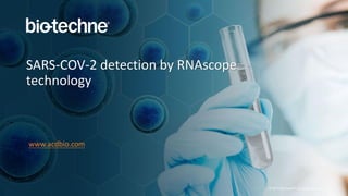 © 2019 Bio-Techne®. All rights reserved.
SARS-COV-2 detection by RNAscope
technology
www.acdbio.com
 