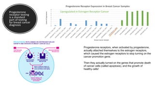 Progesterone
receptor testing
is a standard
part of testing
for breast cancer
diagnosis 0
1
2
3
4
5
6
7
8
LevelofExpression
Breast Cancer Sample
Progesterone Receptor Expression in Breast Cancer Samples
Progesterone receptors, when activated by progesterone,
actually attached themselves to the estrogen receptors,
which caused the estrogen receptors to stop turning on the
cancer promotion gene.
Then they actually turned on the genes that promote death
of cancer cells (called apoptosis), and the growth of
healthy cells!
Upregulated in Estrogen Receptor Cancer
 