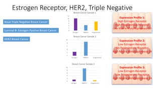 Estrogen Receptor, HER2, Triple Negative
Expression Profile 1:
High Estrogen Receptor
High Progesterone Receptor
Low Matrix Metalloprotease 14
Expression Profile 2:
Low Estrogen Receptor
No Progesterone Receptor
High Matrix Metalloprotease 14
Expression Profile 3:
Low Estrogen Receptor
Low Progesterone Receptor
High Matrix Metalloprotease 14
HER2 Breast Cancer
Luminal B- Estrogen Positive Breast Cancer
Basal-Triple Negative Breast Cancer
0
2
4
6
8
10
12
Estrogen MMP14 Progesterone
Breast Cancer Sample 1
0
2
4
6
8
10
Estrogen MMP14 Progesterone
Breast Cancer Sample 3
0
2
4
6
8
10
Estrogen MMP14 Progesterone
Breast Cancer Sample 2
 