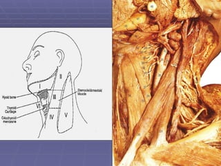 Dissection Neck RADICAL NECK DISSECTION SURGICAL ONCOLOGY | PPT