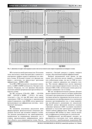 Оригинальные статьи                                                                         Том IV, № 1, 2012




Рис. 3. Динамика четырёх типов вращательного нистагма относительно скорости вращения или поворота головы


   ВН отличается своей монотонностью. Остальные           чинается с быстрой саккады в сторону поворота
типы нистагмов в своей быстрой фазе стремятся к           головы, обусловленной шейной афферентацией.
повторению графика скорости вращения или пово-               Вопреки традиционной точке зрения, ни при
рота головы. В большей степени этот феномен вы-           одном типе нистагма нельзя говорить о слежении
ражен у нистагмов, где присутствует зрительная            или стабилизации взора, так как их СМК не соот-
афферентация – ЦОВН и ОВН.                                ветствует скорости вращения или поворота голо-
   Если ВН и ОВН начинаются с медленного компо-           вы. Чем меньше афферентных систем принимает
нента, то ЦВН и ЦОВН начинаются с быстрого ком-           участие в реализации вращательного нистагма, тем
понента. Очевидно, что этот феномен обусловлен            меньше СМК и СБК, тем большая степень рассогла-
наличием шейной проприоцепции при активных по-            сования в движениях глаз и головы.
воротах головы.                                              ВН как патофизиологическая реакция обладает
   Кр ВН составлял 0,56±0,01; ЦВН – 1,03±0,04;            рядом отрицательных качеств, которые необходимо
ОВН – 1,09±0,05 и ЦОВН – 1,35±0,11. Это свиде-            учитывать при проведении исследований. Этими ка-
тельствует о том, что при ВН имеет место явный            чествами являются торможение нистагма вплоть до
«проигрыш» СМК по отношению к максимальной                исчезновения или преобразования его в тоническую
скорости вращения, а при ЦОВН, когда гармонично           реакцию противовращения глаз, а также выражен-
функционируют все афферентные системы, – несо-            ная нестабильность асимметрии его показателей.
мненный «выигрыш».                                        Причиной данных феноменов являются следовые
   Резюме.                                                и фазовые процессы в ЦНС в условиях пассивного
   На основании полученных результатов нами               вращения и отсутствия зрительной и проприоцеп-
сформулирована физиологическая концепция реа-             тивной шейной афферентации. Возможно, что при
лизации нистагма при активном повороте головы.            исследовании ВН вообще не имеет смысла вычис-
Эта реакция расценивается как ориентировочная,            лять коэффициенты асимметрии его показателей.
направленная на опережающее выведение глаз в                 Периферический вестибулярный синдром ха-
сторону предполагаемого информационно значи-              рактеризуется угнетением всех типов вращатель-
мого объекта, куда поворачивается голова. Она на-         ного нистагма с преобладающим подавлением ВН.

 52                                           Russian Neurosurgical Journal named after professor A.L. Polenov
 