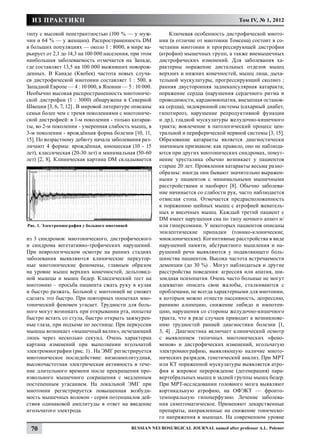 ИЗ ПРАКТИКИ                                                                                Том IV, № 1, 2012

типу с высокой пенетрантностью (100 % — у муж-                  Ключевая особенность дистрофической миото-
чин и 64 % — у женщин). Распространенность DM              нии (в отличие от миотонии Томсена) состоит в со-
в больших популяциях — около 1 : 8000, в мире ва-          четании миотонии и прогрессирующей дистрофии
рьирует от 2,1 до 14,3 на 100 000 населения, при этом      (атрофии) мышечных групп, а также внемышечных
наибольшая заболеваемость отмечается на Западе,            дистрофических изменений. Для заболевания ха-
где составляет 13,5 на 100 000 выживших новорож-           рактерны поражение дистальных отделов мышц
денных. В Канаде (Квебек) частота новых случа-             верхних и нижних конечностей, мышц лица, дыха-
ев дистрофической миотонии составляет 1 : 500, в           тельной мускулатуры, прогрессирующий сколиоз ;
Западной Европе — 4 : 10 000, в Японии — 5 : 10 000.       ранняя двусторонняя заднекапсулярная катаракта;
Необычно высокая распространенность миотониче-             поражение сердца (нарушения сердечного ритма и
ской дистрофии (1 : 3000) обнаружена в Северной            проводимости, кардиомиопатия, внезапная останов-
Швеции [3, 6, 7, 12] . В мировой литературе описаны        ка сердца), эндокринной системы (сахарный диабет,
семьи более чем с тремя поколениями с миотониче-           гипотиреоз, нарушение репродуктивной функции
ской дистрофией: в 1-м поколении - только катарак-         и др.), гладкой мускулатуры желудочно-кишечного
ты, во 2-м поколении - умеренная слабость мышц, в          тракта; вовлечение в патологический процесс цен-
3-м поколении - врождённая форма болезни [10, 11,          тральной и периферической нервной системы [3, 15].
15]. По возрастному дебюту начала заболевания раз-         Образование катаракты является диагностически
личают 4 формы: врождённая, юношеская (10 - 15             значимым признаком: как правило, оно не наблюда-
лет), классическая (20-30 лет) и минимальная (50-60        ются при других миотонических синдромах, помут-
лет) [2, 8]. Клиническая картина DM складывается           нение хрусталика обычно возникает у пациентов
                                                           старше 20 лет. Проявления катаракты весьма разно-
                                                           образны: иногда они бывают значительно выражен-
                                                           ными у пациентов с минимальными мышечными
                                                           расстройствами и наоборот [8]. Обычно заболева-
                                                           ние начинается со слабости рук, часто наблюдается
                                                           отвислая стопа. Отмечается предрасположенность
                                                           к поражению шейных мышц с атрофией жеватель-
                                                           ных и височных мышц. Каждый третий пациент с
                                                           DM имеет нарушения сна по типу ночного апноэ и/
Рис. 1. Электромиография у больного миотонией              или гиперсомнии. У некоторых пациентов описаны
                                                           эпилептические припадки (тонико-клонические,
из 3 синдромов: миотонического, дистрофического            миоклонические). Когнитивные расстройства в виде
и синдрома вегетативно-трофических нарушений.              нарушений памяти, абстрактного мышления и на-
При неврологическом осмотре на ранних стадиях              рушений речи выявляются у подавляющего боль-
заболевания выявляются клинические перкутор-               шинства пациентов. Высока частота встречаемости
ные миотонические феномены, главным образом                деменции (до 30 %) . Могут наблюдаться и другие
на уровне мышц верхних конечностей, дельтовид-             расстройства поведения: агрессия или апатия, ши-
ной мышцы и мышц бедер. Классический тест на               зоидная психопатия. Очень часто больные не могут
миотонию – просьба пациента сжать руку в кулак             адекватно описать свои жалобы, сталкиваются с
и быстро разжать. Больной с миотонией не сможет            проблемами, не всегда характерными для миотонии,
сделать это быстро. При повторных попытках мио-            к которым можно отнести пассивность, депрессию,
тонический феномен угасает. Трудности для боль-            раннюю алопецию, снижение либидо и импотен-
ного могут возникать при открывании рта, попытке           цию, нарушения со стороны желудочно-кишечного
быстро встать со стула, быстро открыть зажмурен-           тракта, что в ряде случаев приводит к возникнове-
ные глаза, при подъеме по лестнице. При перкуссии          нию трудностей ранней диагностики болезни [1,
мышцы возникает «мышечный валик», исчезающий               3, 4] . Диагностика включает клинический осмотр
лишь через несколько секунд. Очень характерна              с выявлением типичных миотонических «фено-
картина изменений при выполнении игольчатой                менов» и дистрофических изменений, игольчатую
электромиографии (рис. 1) . На ЭМГ регистрируется          электромиографию, выявляющую наличие миото-
миотоническое последействие: низкоамплитудная,             нических разрядов, генетический анализ. При МРТ
высокочастотная электрическая активность в тече-           или КТ пораженной мускулатуры выявляется атро-
ние длительного времени после прекращения про-             фия и жировое перерождение (дегенерация) пара-
извольного мышечного сокращения с медленным                вертебральных мышц и задней группы мышц бедер.
постепенным угасанием. На локальной ЭМГ при                При МРТ-исследовании головного мозга выявляют
миотонии регистрируется повышенная возбуди-                кортикальную атрофию, на ОФЭКТ — фронто-
мость мышечных волокон - серия потенциалов дей-            темпоральную гипоперфузию. Лечение заболева-
ствия одинаковой амплитуды в ответ на введение             ния симптоматическое. Применяют лекарственные
игольчатого электрода.                                     препараты, направленные на снижение тоническо-
                                                           го напряжения в мышцах. На современном уровне

 70                                             Russian Neurosurgical Journal named after professor A.L. Polenov
 