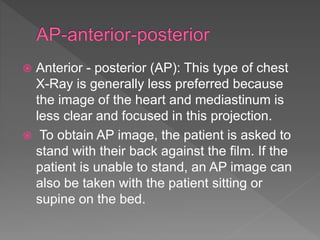  Anterior - posterior (AP): This type of chest
X-Ray is generally less preferred because
the image of the heart and mediastinum is
less clear and focused in this projection.
 To obtain AP image, the patient is asked to
stand with their back against the film. If the
patient is unable to stand, an AP image can
also be taken with the patient sitting or
supine on the bed.
 