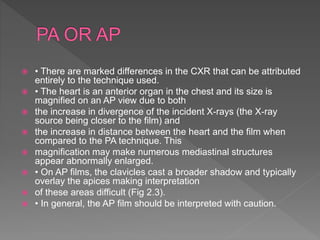  • There are marked differences in the CXR that can be attributed
entirely to the technique used.
 • The heart is an anterior organ in the chest and its size is
magnified on an AP view due to both
 the increase in divergence of the incident X-rays (the X-ray
source being closer to the film) and
 the increase in distance between the heart and the film when
compared to the PA technique. This
 magnification may make numerous mediastinal structures
appear abnormally enlarged.
 • On AP films, the clavicles cast a broader shadow and typically
overlay the apices making interpretation
 of these areas difficult (Fig 2.3).
 • In general, the AP film should be interpreted with caution.
 