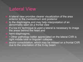  A lateral view provides clearer visualization of the area
anterior to the mediastinum and posterior
 to the diaphragms and may help interpretation of an
abnormality seen on a frontal view
 If a low kV technique is used a lateral is necessary to image
the areas behind the heart and
 hemi-diaphragms.
 • Other pathology better appreciated on the lateral CXR is
right middle lobe or lingularr collapse
 and/or consolidation, which may be missed on a frontal CXR
due to the orientation of the X-ray beam
 