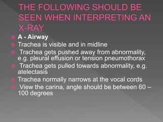  A - Airway
 Trachea is visible and in midline
 Trachea gets pushed away from abnormality,
e.g. pleural effusion or tension pneumothorax
 Trachea gets pulled towards abnormality, e.g.
atelectasis
 Trachea normally narrows at the vocal cords
 View the carina, angle should be between 60 –
100 degrees
 