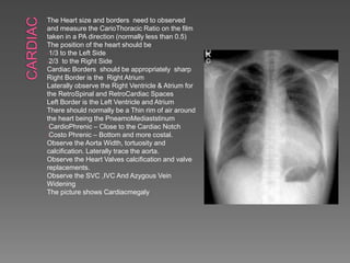 The Heart size and borders need to observed
and measure the CarioThoracic Ratio on the film
taken in a PA direction (normally less than 0.5)
The position of the heart should be
-1/3 to the Left Side
-2/3 to the Right Side
Cardiac Borders should be appropriately sharp
Right Border is the Right Atrium
Laterally observe the Right Ventricle & Atrium for
the RetroSpinal and RetroCardiac Spaces
Left Border is the Left Ventricle and Atrium
There should normally be a Thin rim of air around
the heart being the PneamoMediaststinum
-CardioPhrenic – Close to the Cardiac Notch
-Costo Phrenic – Bottom and more costal.
Observe the Aorta Width, tortuosity and
calcification. Laterally trace the aorta.
Observe the Heart Valves calcification and valve
replacements.
Observe the SVC ,IVC And Azygous Vein
Widening
The picture shows Cardiacmegaly
 