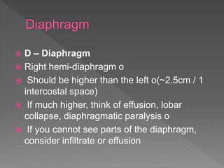  D – Diaphragm
 Right hemi-diaphragm o
 Should be higher than the left o(~2.5cm / 1
intercostal space)
 If much higher, think of effusion, lobar
collapse, diaphragmatic paralysis o
 If you cannot see parts of the diaphragm,
consider infiltrate or effusion
 