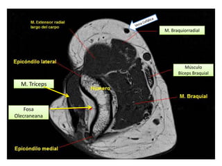 M. Braquiorradial




                        Músculo
                     Bíceps Braquial

  M. Tríceps



    Fosa
Olecraneana
 