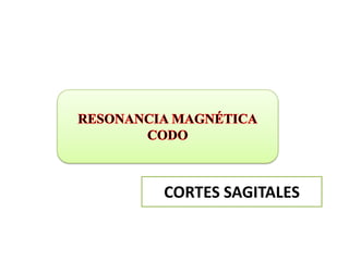 CORTES SAGITALES
 
