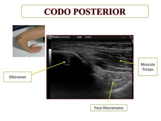 Músculo
                               Tríceps
Olécranon




            Fosa Olecraneana
 