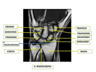 GRANDE
                                  TRAPECIO
 GANCHOSO
                                  TRAPEZOIDE
 PIRAMIDAL                        ESCAFOIDES

A.                                SEMILUNAR
RADIOCARPIANA


   CÚBITO                            RADIO




                A. RADIOCUBITAL
 