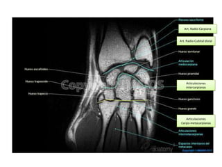 Art. Radio-Carpiana


Art. Radio-Cubital distal




    Articulaciones
    intercarpianas




    Articulaciones
 Carpo-metacarpianas
 