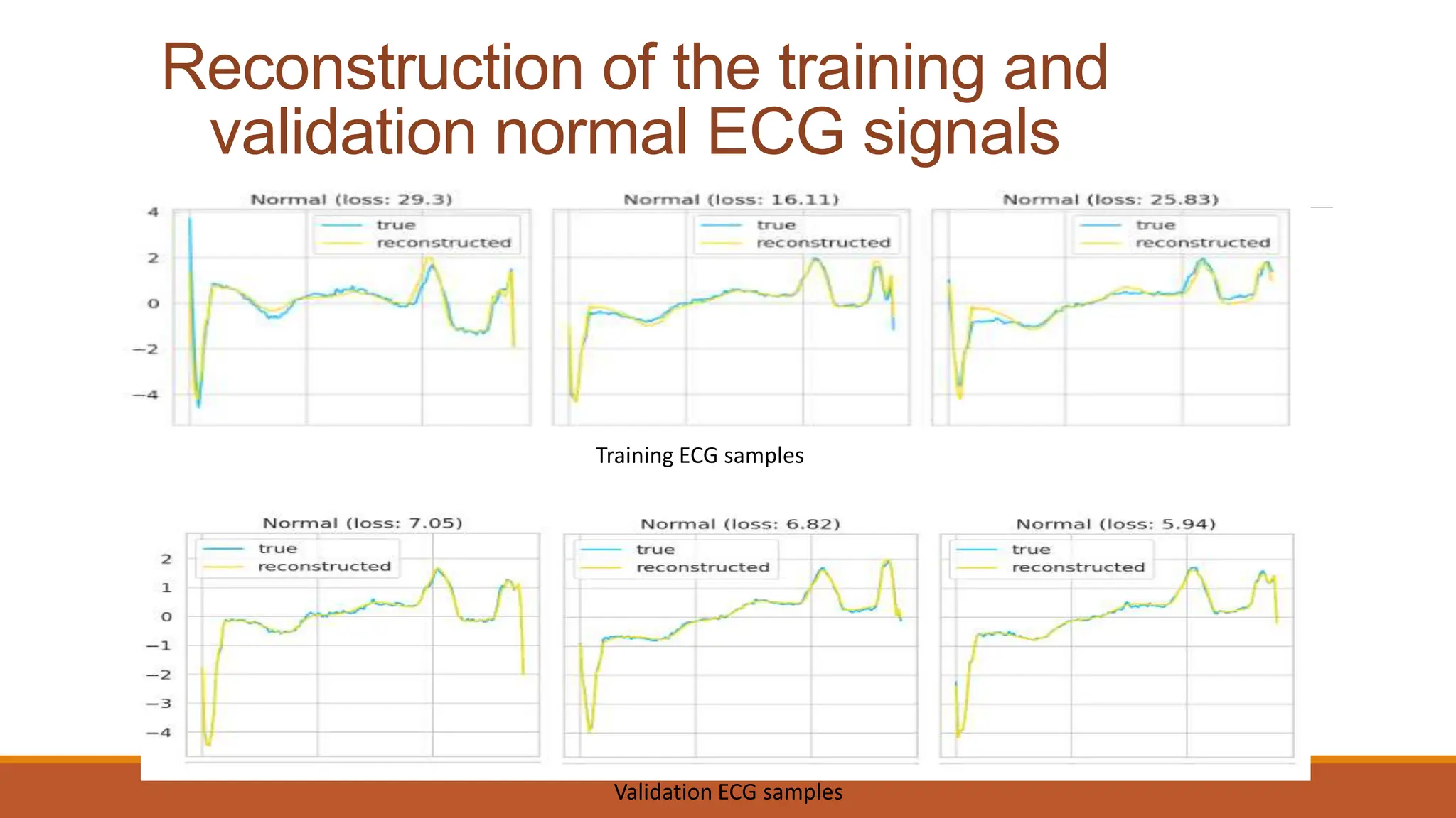 Reconstruction of the training and
validation normal ECG signals
Training ECG samples
Validation ECG samples
 