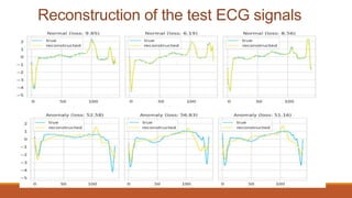 Reconstruction of the test ECG signals
 