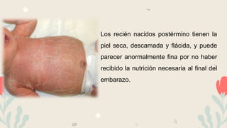 Los recién nacidos postérmino tienen la
piel seca, descamada y flácida, y puede
parecer anormalmente fina por no haber
recibido la nutrición necesaria al final del
embarazo.
 