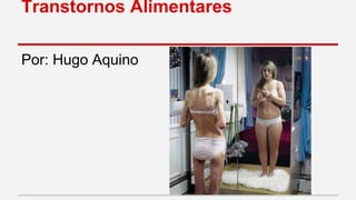 Transtornos Alimentares 
Por: Hugo Aquino 
 