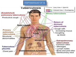 SYMPTOMATOLOGY OF T.B.
 