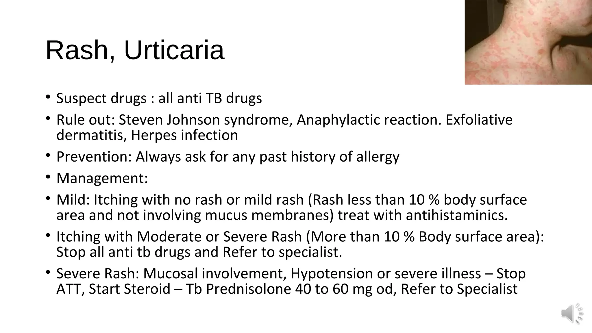 ADR to Anti Tuberculosis Drugs | PPT