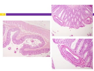 RNT lecture 2012 Worms of the large intestine | PDF