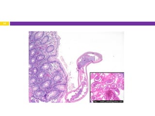 RNT lecture 2012 Worms of the large intestine | PDF