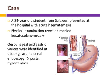 Case
   A 22-year-old student from Sulawesi presented at
    the hospital with acute haematemesis
   Physical examinatio...